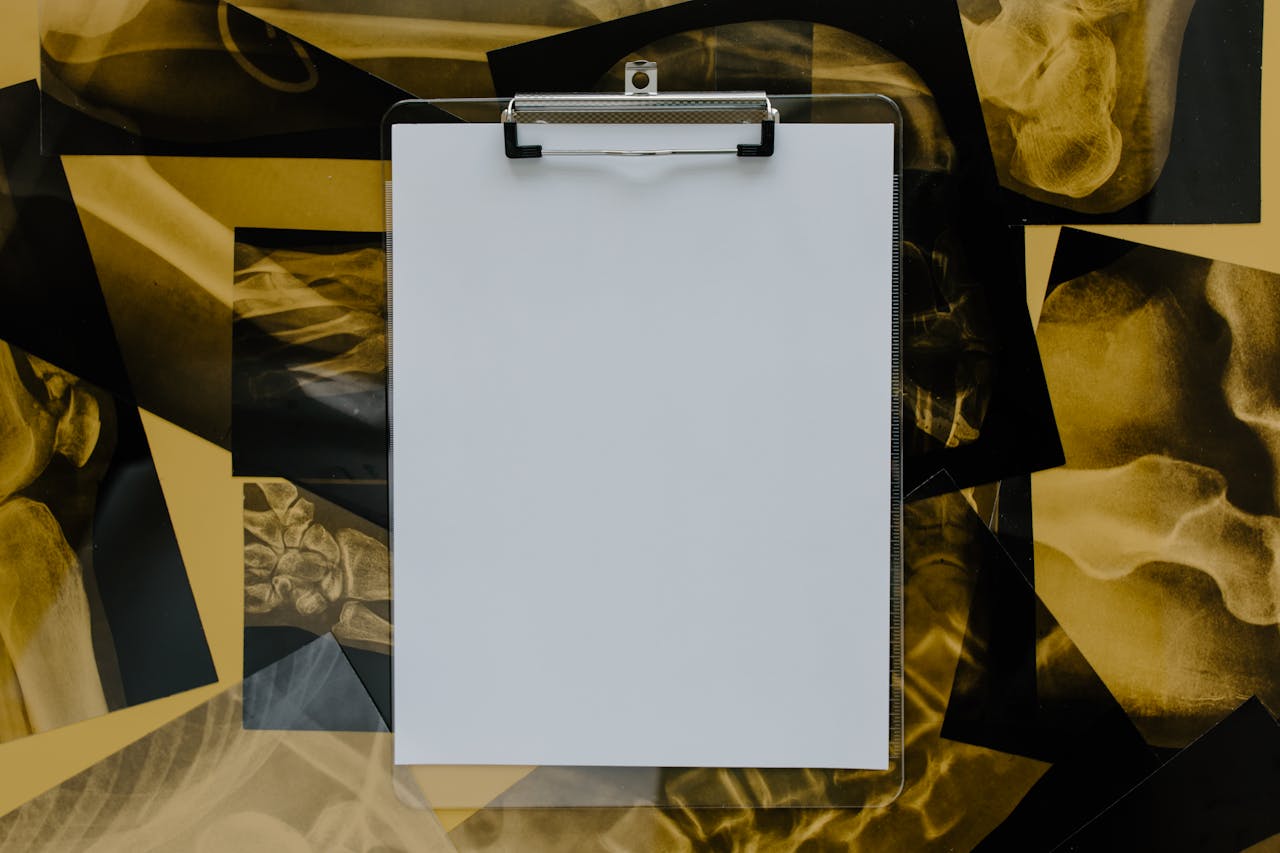 Top view of a blank clipboard on a background of various skeletal x-ray images, ideal for medical themes.